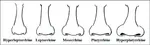 ariations-in-the-nasal-morphology-based-on-nasal-index.png