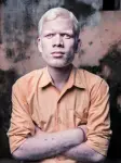 BlindAlbinism_15.webp