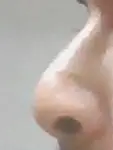 nose_side.jpg